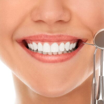 Best Age to Remove Wisdom Teeth