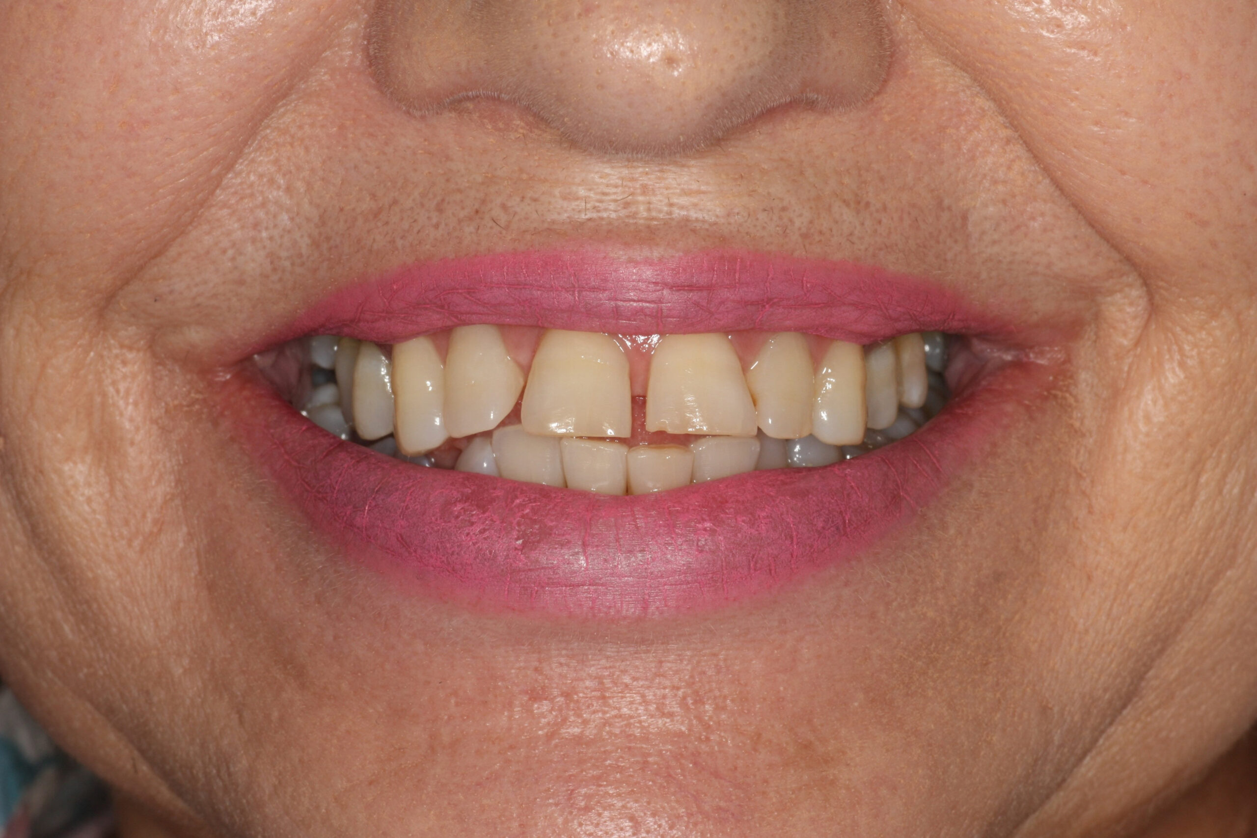 Orthodontics1-1