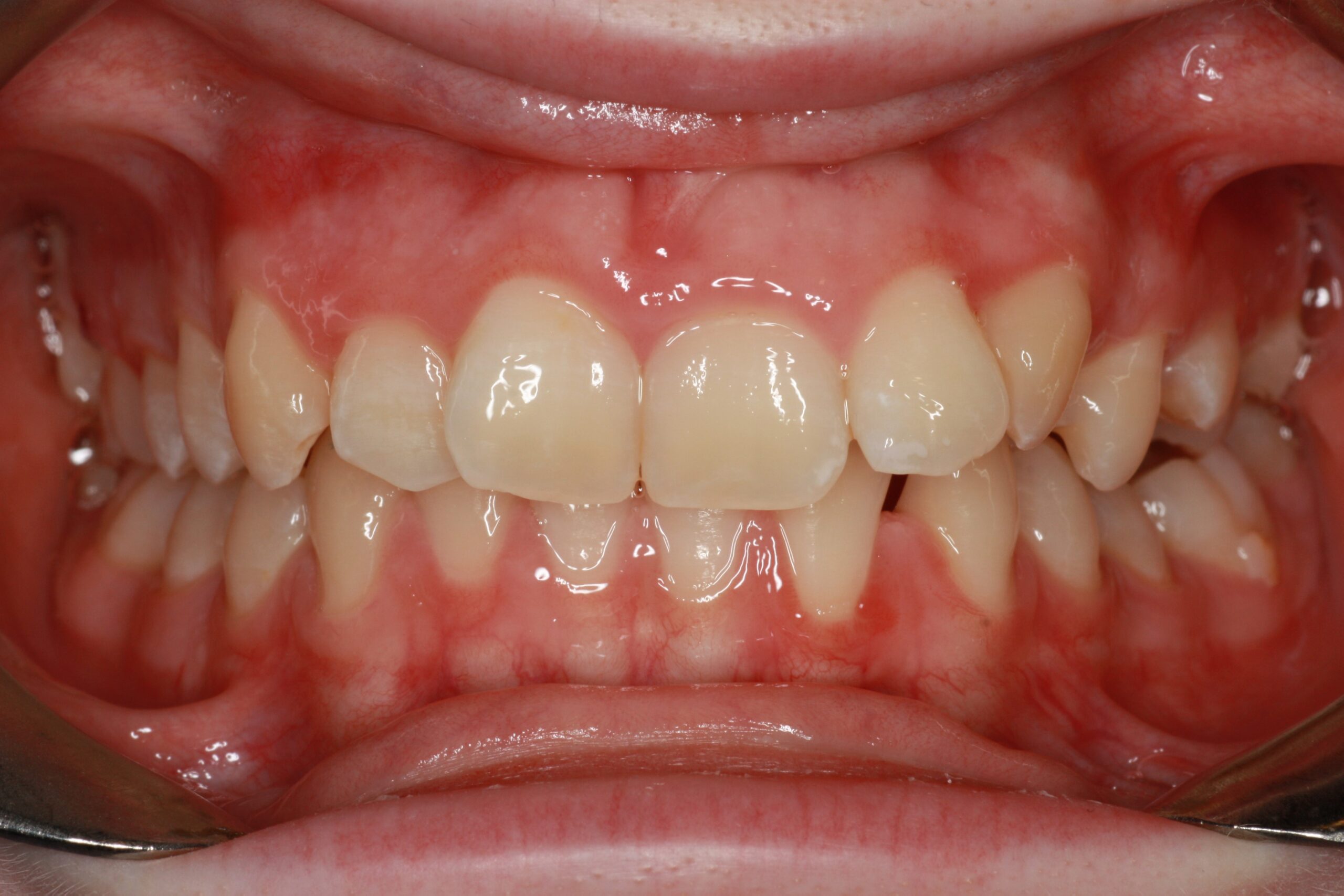 Orthodontics2-2