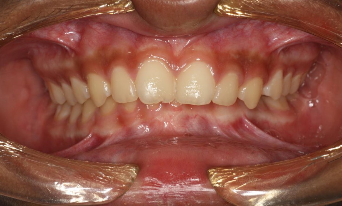Orthodontics3-1