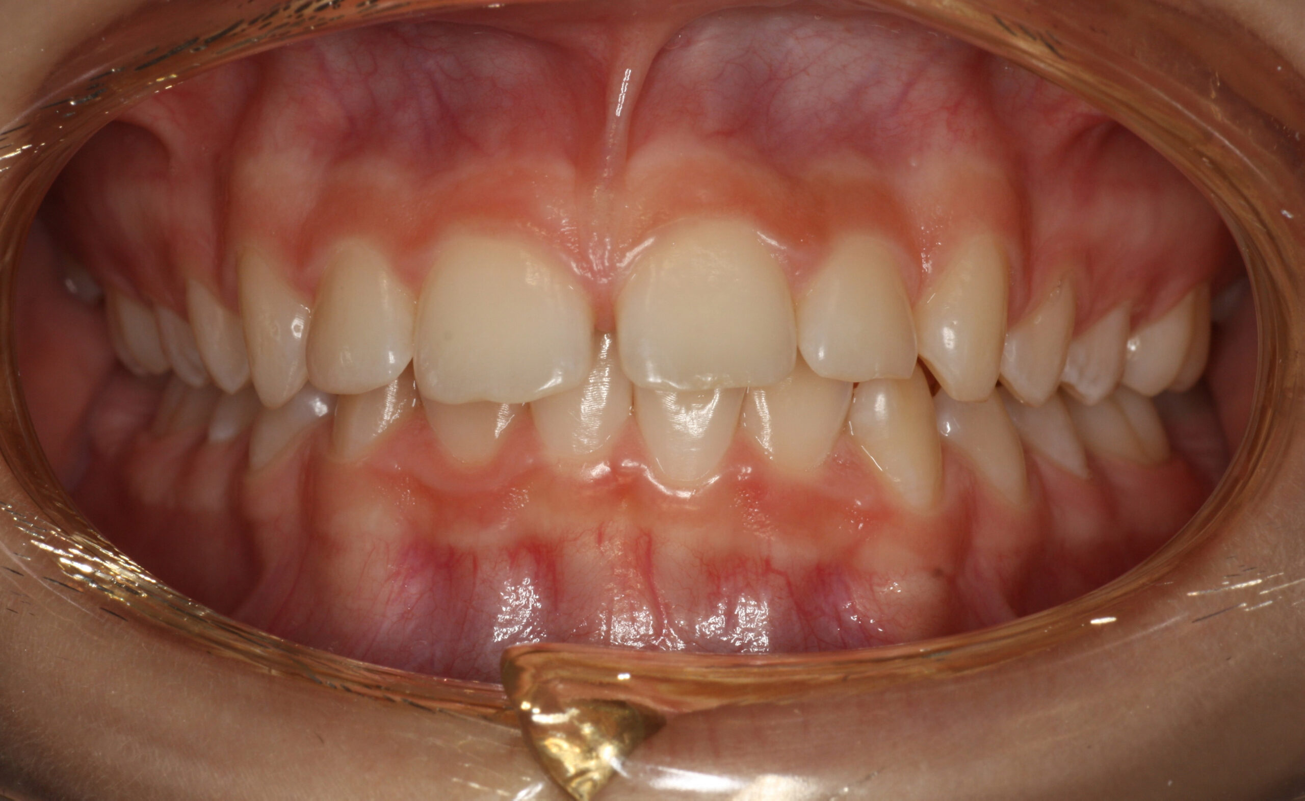 Orthodontics5-1