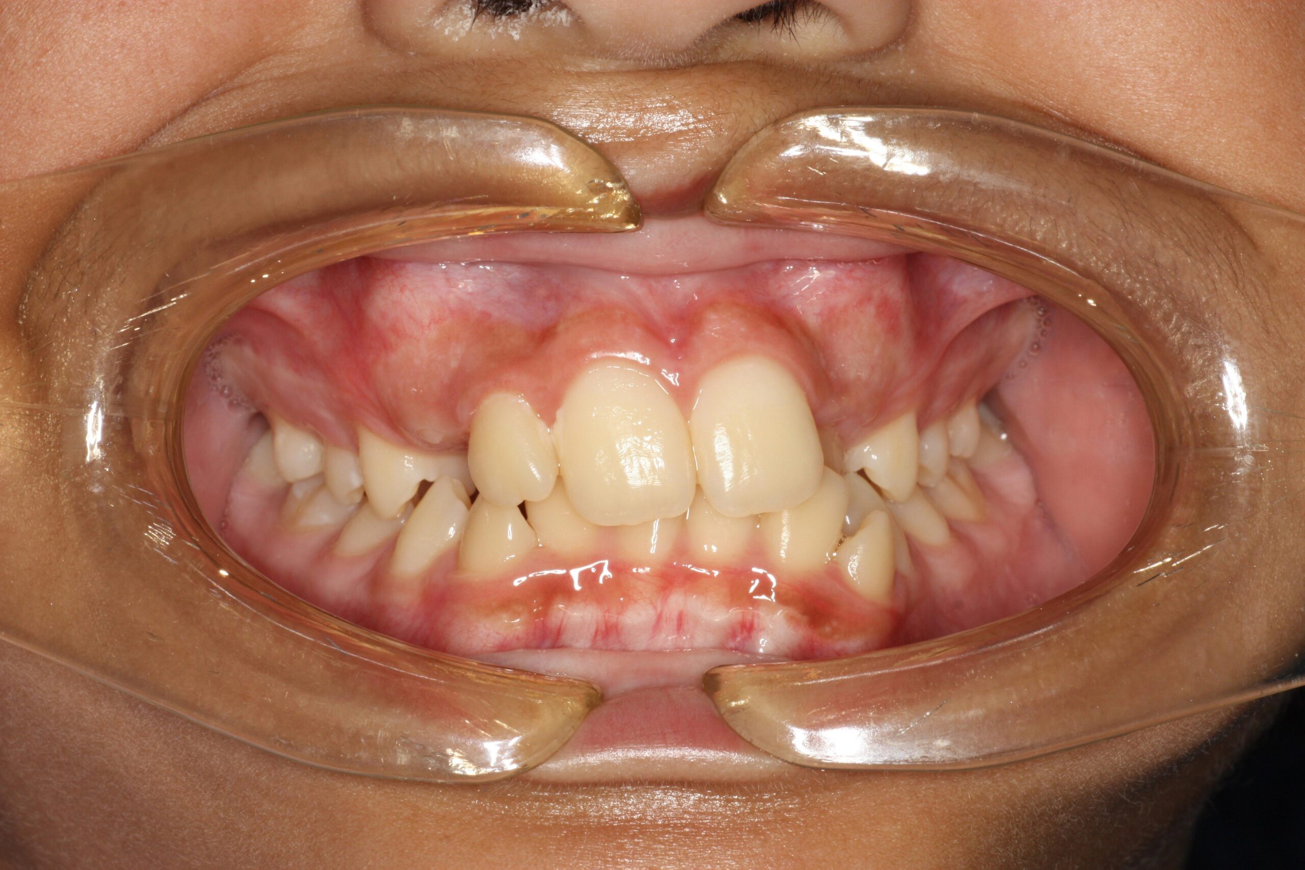 Orthodontics6-2