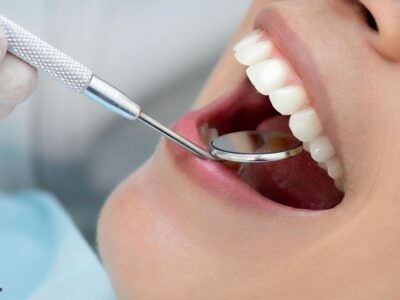 Cosmetic Dentistry